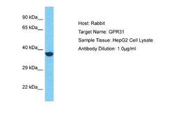 GPR31 Antibody, Novus Biologicals 100 &mu;L | Buy Online | Novus Biologicals | Fisher Scientific